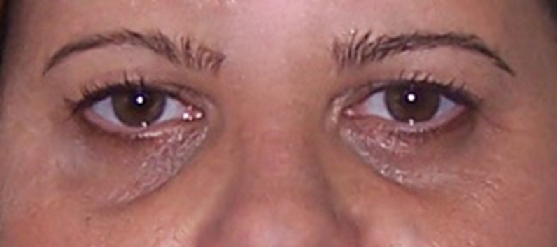 olhos