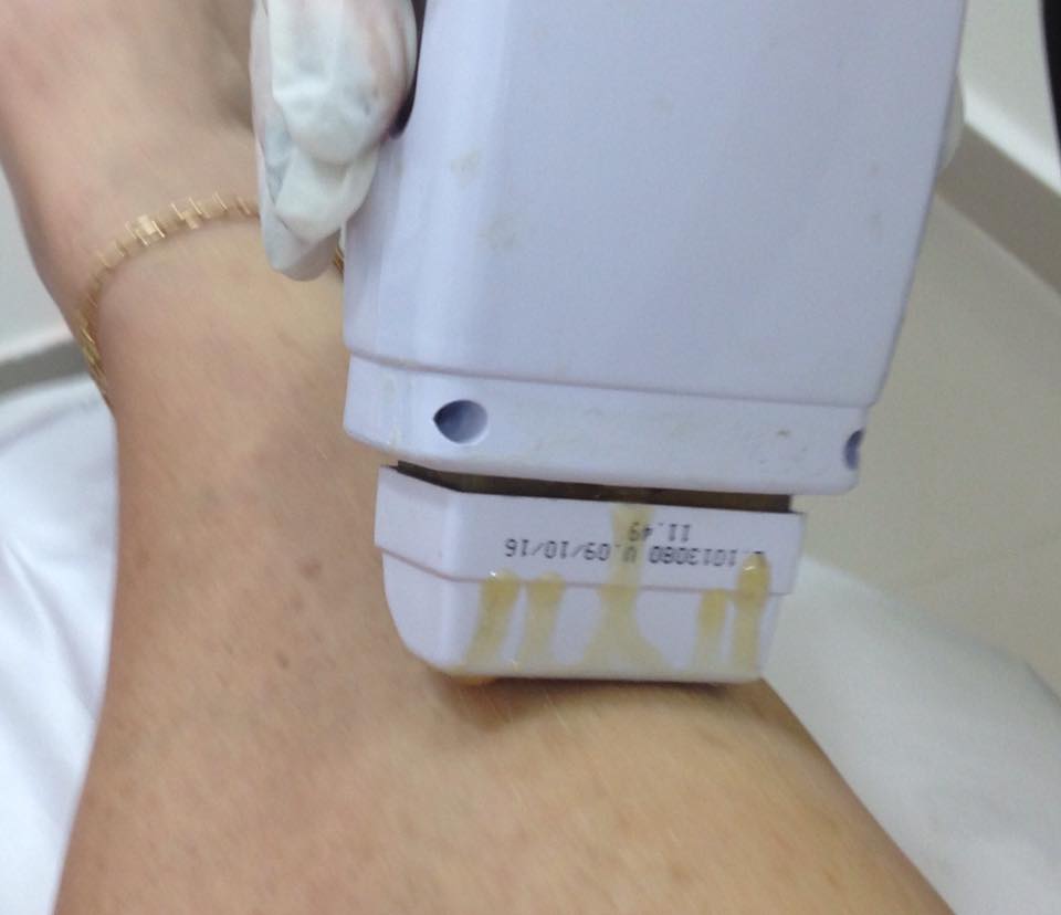 11251587_893387107366159_1686763015_n